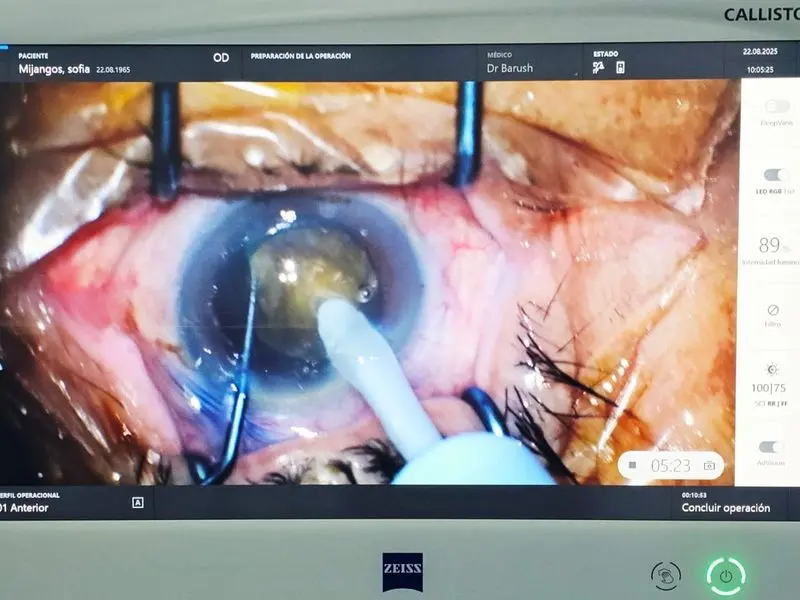 Cirugía de cataratas con equipo Zeiss en Oaxaca — Centro Oftalmológico Aether