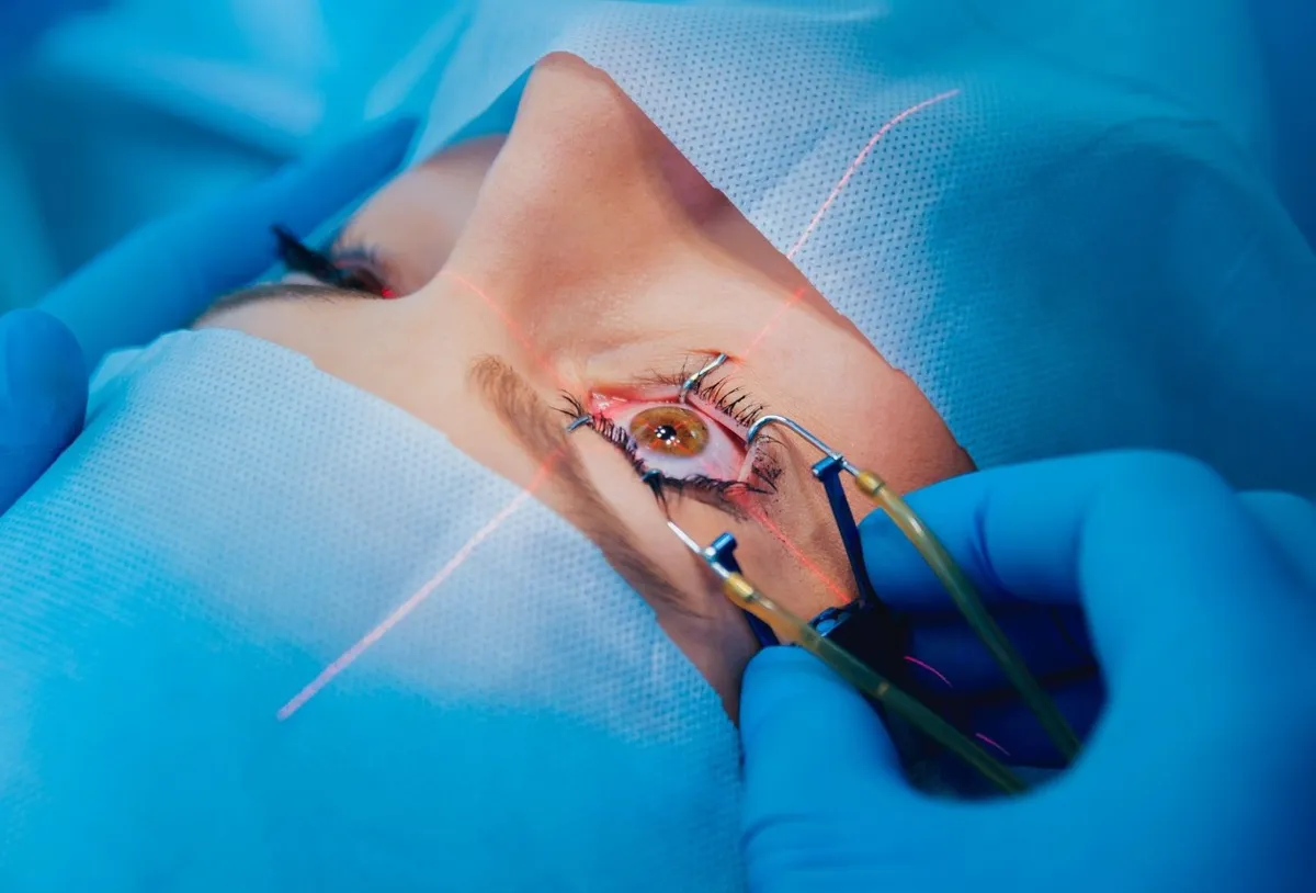 Cirugía LASIK con láser excímer — corrección refractiva en Oaxaca